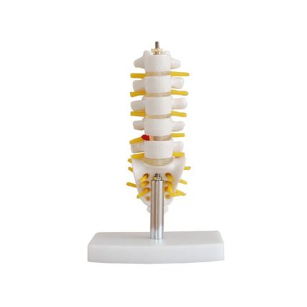 SA/119A Mini Lumbar Vertebrae with Sacrum & Coccyx and Herniated Disc Model